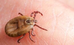 Sivas’ta Kırım Kongo Kanamalı Ateşi Şüphesiyle Bir Can Kaybı Daha